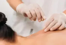 Clínica de acupuntura que aceita convênio