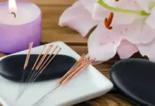 Como funciona a acupuntura