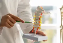 Ortopedista especialista em osteoporose