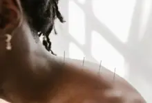 Quanto custa uma sessão de acupuntura