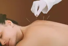 Acupuntura desinflama