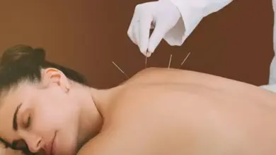 Acupuntura desinflama