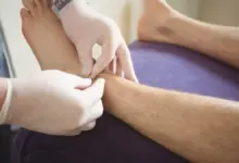 Acupuntura no tornozelo
