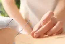 Acupuntura para bico de papagaio