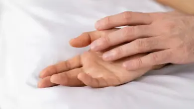 Sinovite no dedo da mão