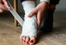 Cirurgia de joanete dói muito