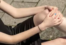 Luxação recidivante da patela