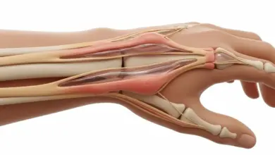 Tenossinovite dos extensores
