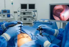 Cirurgia no ombro a laser
