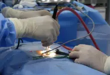 Cirurgia de hérnia de disco pode deixar paraplégico