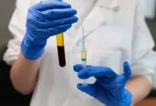 PRP ou viscossuplementação no joelho