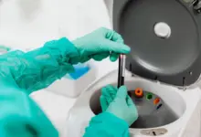PRP para reparo no menisco