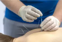 Cuidados após acupuntura