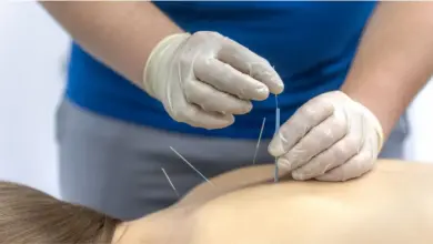Cuidados após acupuntura