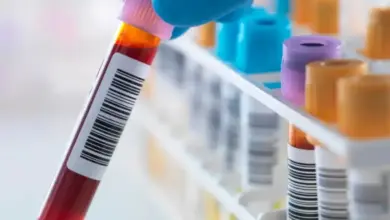 Por que o ortopedista pede exame de sangue